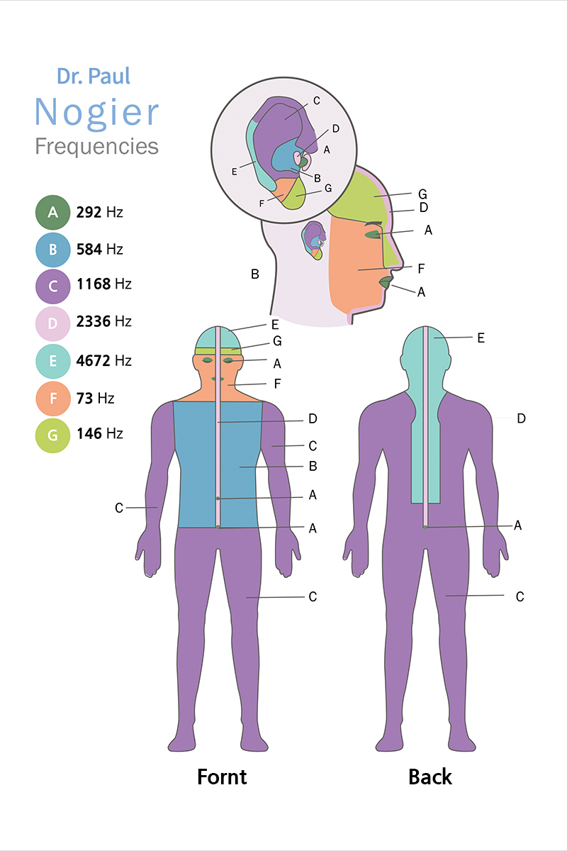 전신광선챔버 방열 기술